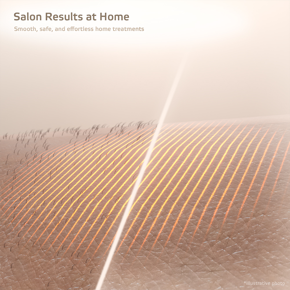 IPL epilátor inSPORTline Eriva