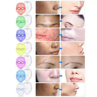 LED Face Mask Light Therapy inSPORTline Manahil