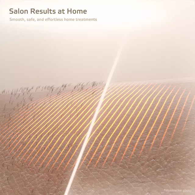 IPL epilátor inSPORTline Aphira