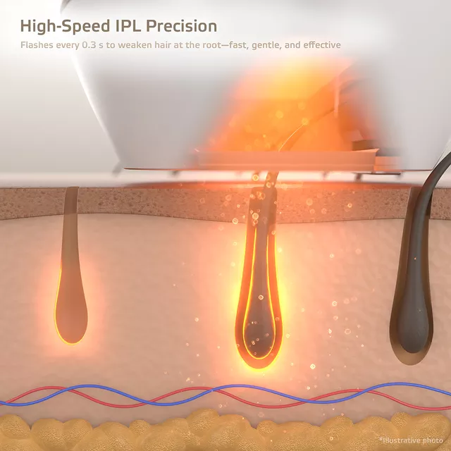 IPL epilátor inSPORTline Aphira