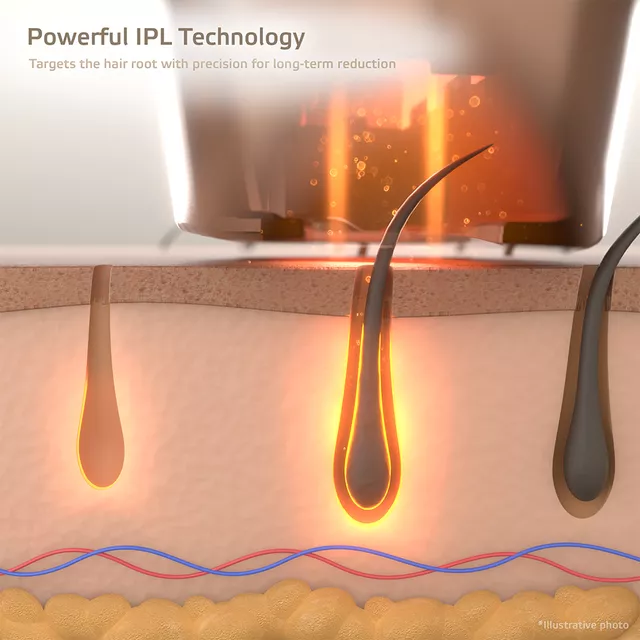 IPL epilátor inSPORTline Eriva
