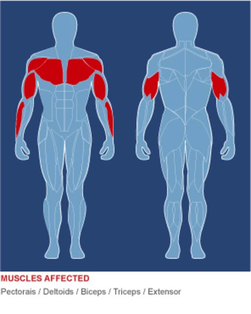 Maszyna na mięśnie klatki piersiowej inSPORTline Body-Solid SBP-100G/2