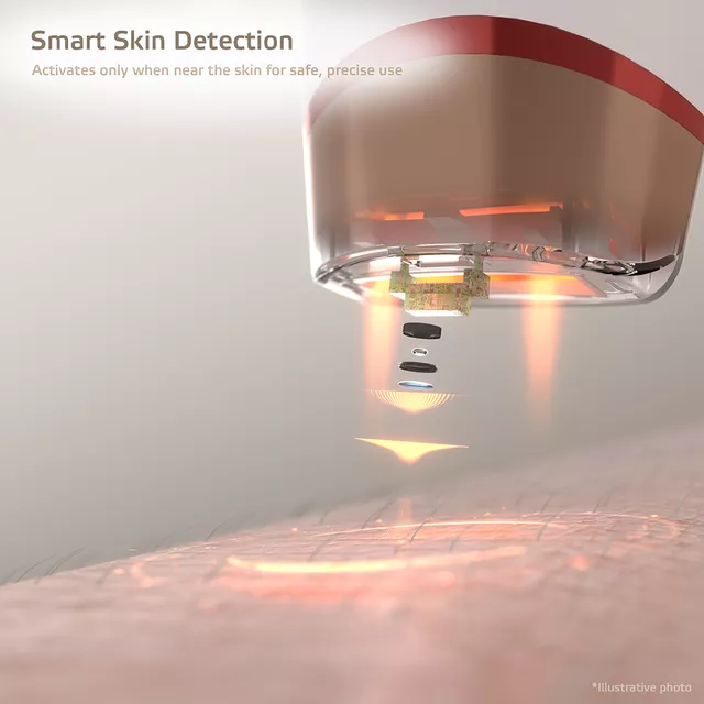 IPL epilátor inSPORTline Eriva