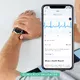 Withings Scanwatch 42mm aktivitásmérő óra fehér